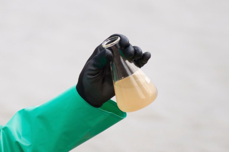 The Most Common Diseases Caused by Water Pollution 