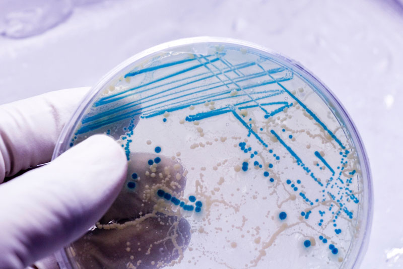 a person holding a petri dish
